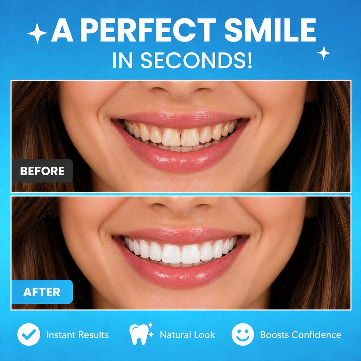 Levinea Insta Veneers™