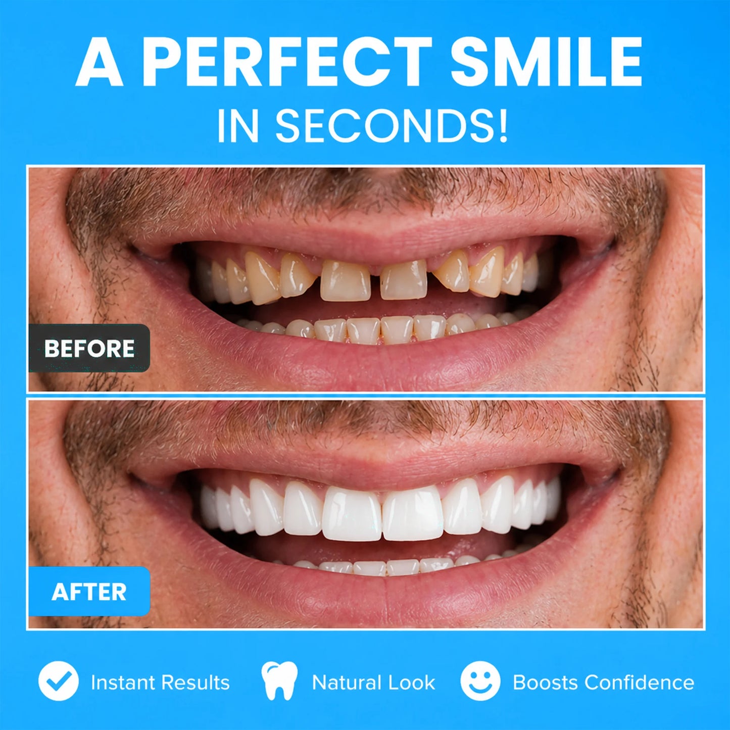 Levinea Insta Veneers™