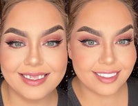 Levinea Insta Veneers™