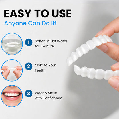 Levinea Insta Veneers™